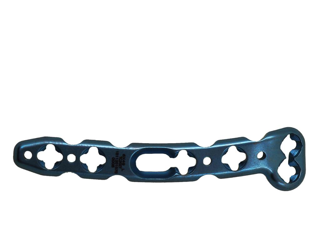 2,4 мм Блокированная VA дорсальная срединная ...,